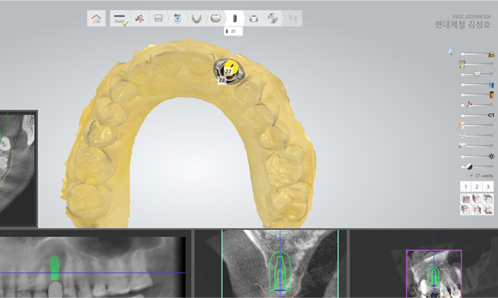 3D-CT